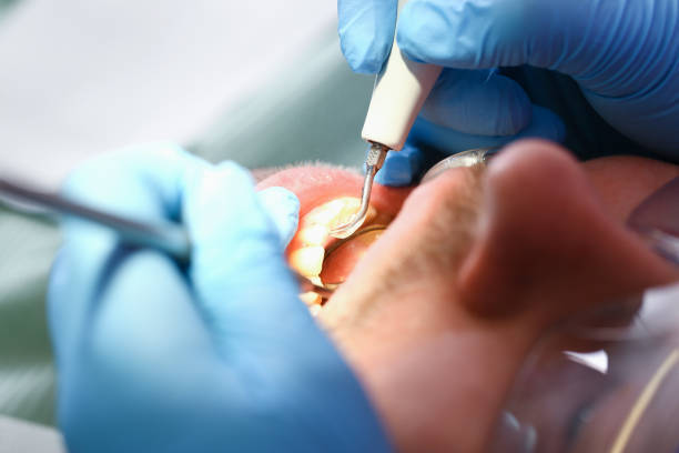 Best After-Hours Dental Trauma Care in Aspermont, TX
