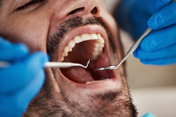 Best Same-Day Emergency Dental Services in Aspermont, TX
